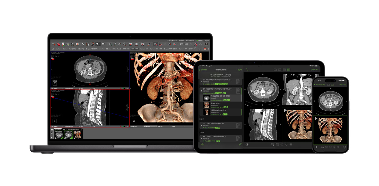 O software exibe o app Visage, usado por radiologistas para interpretar grandes arquivos de diagnóstico.